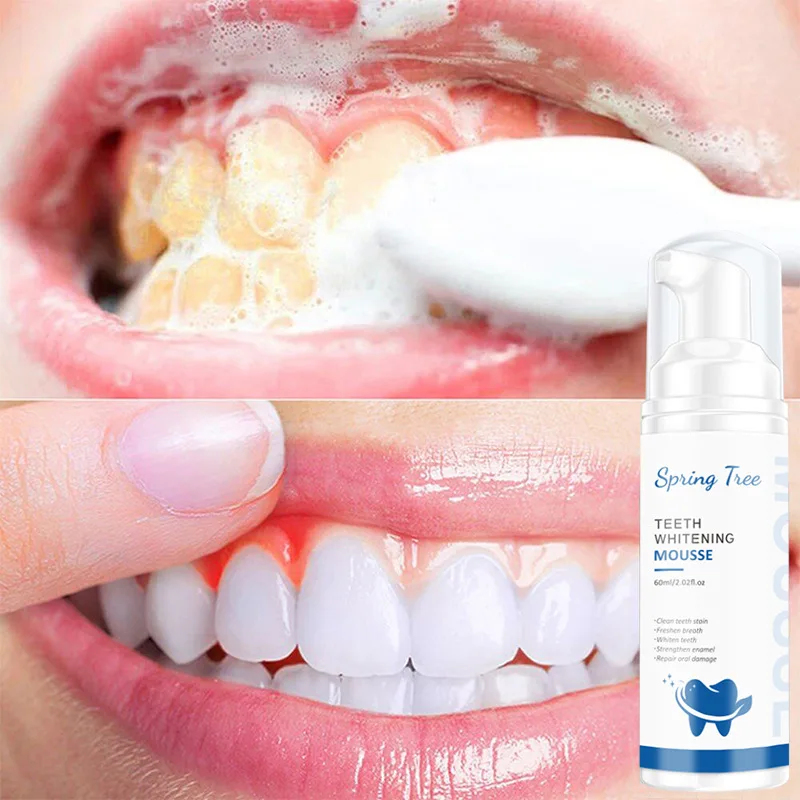 Teeth Whitening Mousse Tooth Whitening Cleaning White Teeth Oral Hygiene Toothpaste Bleaching Remove Stains