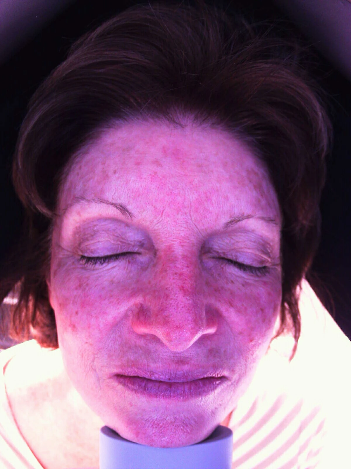 Best skin analyzer digital skin analyzer with skin analysis camera