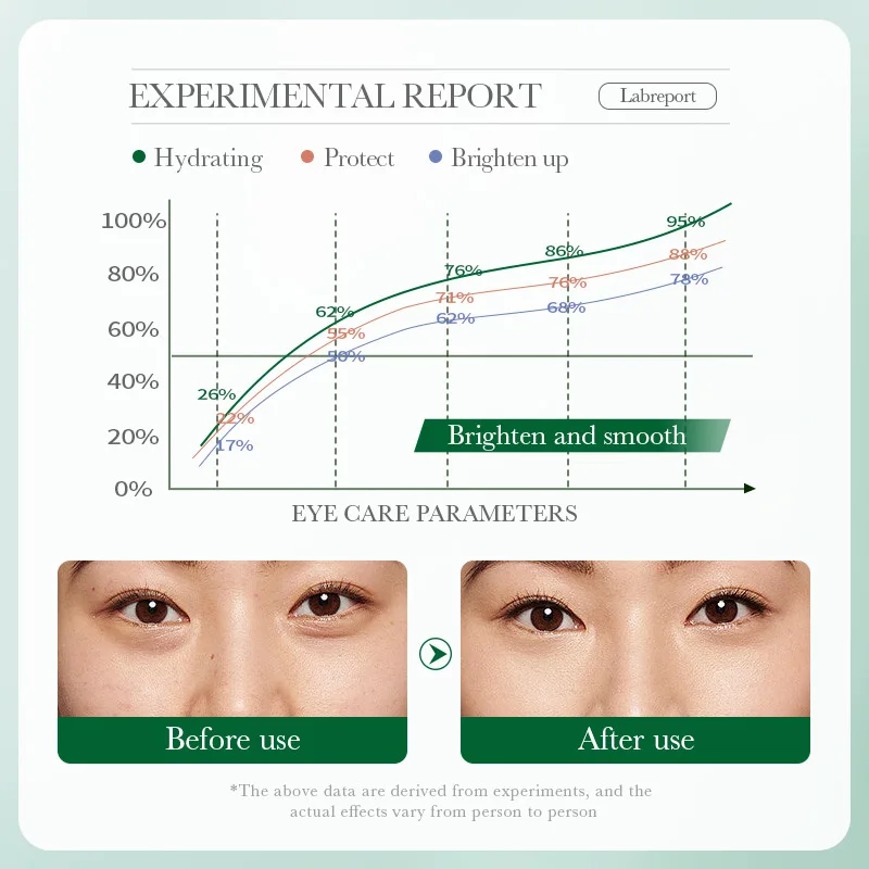 ZOZU Olive oil Eye Cream 20g  improves dark circles and bags under the eyes  Repair smooth skin