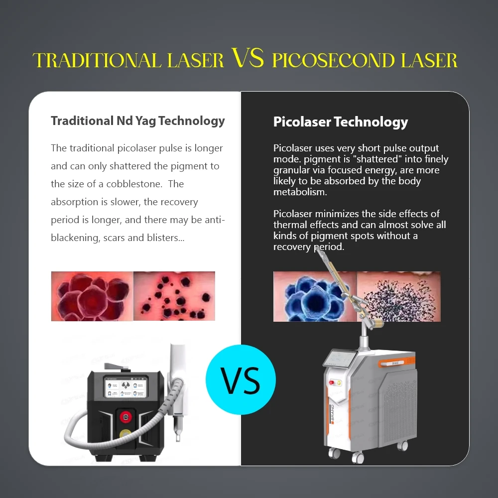2024 picosecond laser pico laser tattoo removal machine price