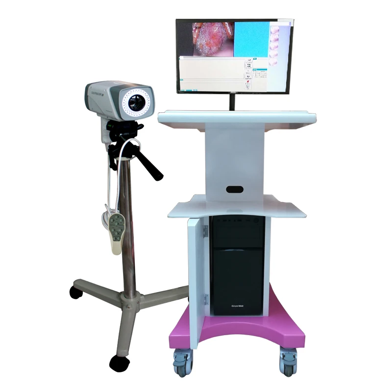 HD digital video colposcope/gyneology health colposcopy camera