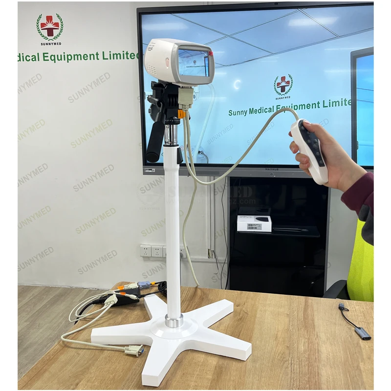 SY-F005-1 высокопроизводительный цифровой видео кольпоскоп для гинекологии с тележкой