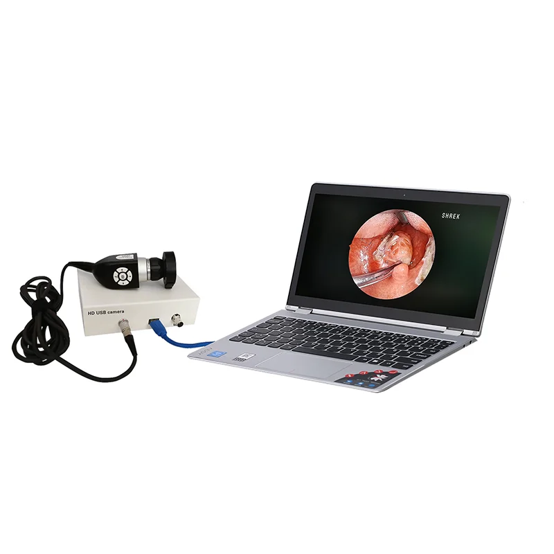 Portable endoscopy hd camera system set medical equipment with USB for gynecology hysteroscopy resectoscope