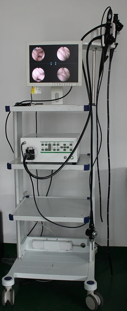 Medical Equipment Portable Endoscope with Video Fiber Colonoscope and Fiber Gastroscope for Veterinary use