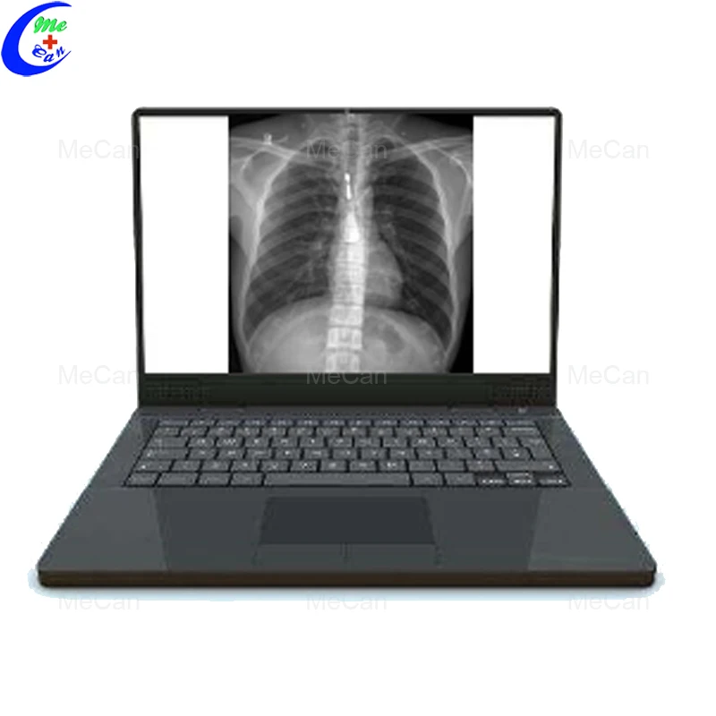 
Medical Equipment High Frequency Mobile DR Digital X Ray Machine 