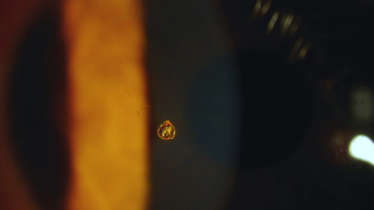 THR-SER Cheapest Ophthalmic Digital Slit Lamp Prices Optical Instrument For Sale