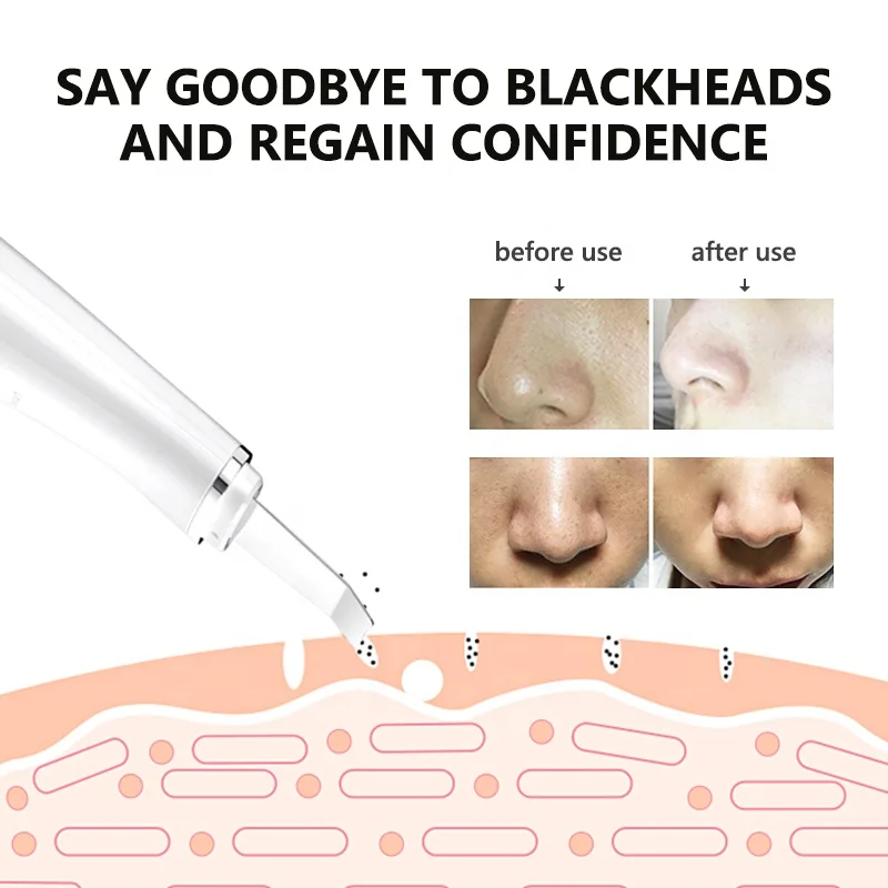 Facial EMS Electronic Micro Stimulating Skin Peeling Pore Cleaning Ultrasonic Skin Scrubber Spatula