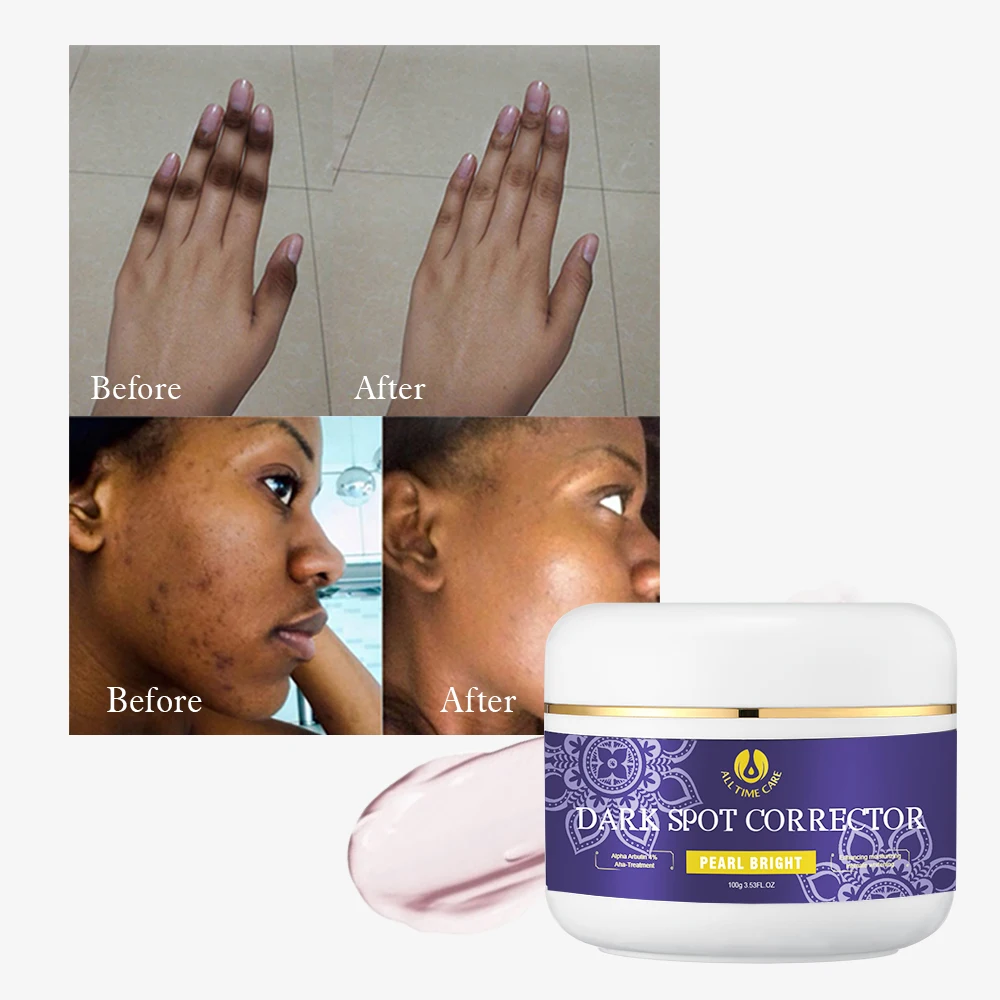 Top! Ginseng Face Pimple Care Firming Cream Remover Reduce Fine Line Whitening Neck Cream Anti Black Spots Cream