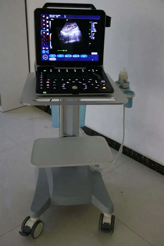  Усовершенствованная кардиографическая ультразвуковая машина 3d 4d/цветной допплер на колесиках цена