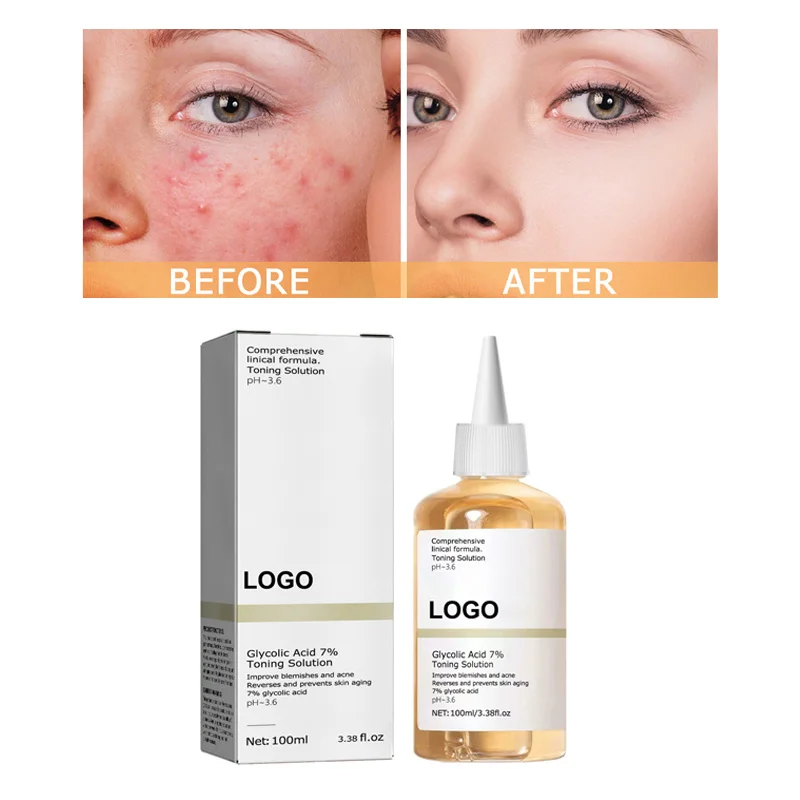 Private Label Lactic Acid Facial Exfoliating Shrink Pore Minimizer Acne Treatment Glycolic Acid 7% Toning Solution