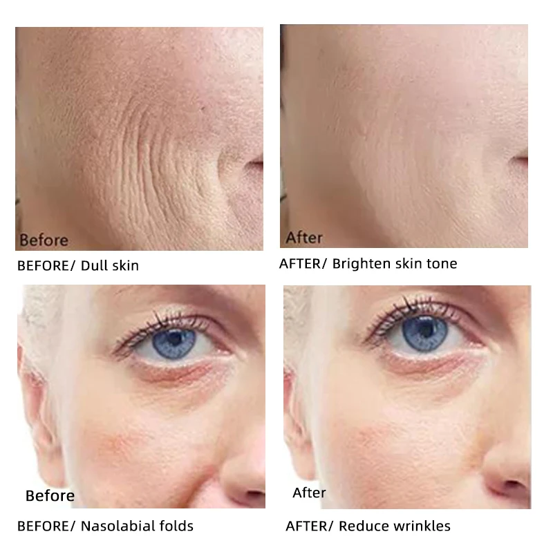 Wholesale Serum Facial Removes Dark Spot Natural Paraben-Free Lightening Skin Tone Vegan Organic Vitamin C Serum Anti Aging