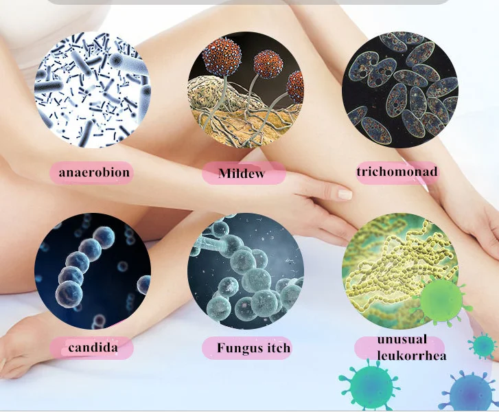 Бесплатный образец Собственная марка Женское здоровье флора баланс уход за влагалищем пробиотический порошок