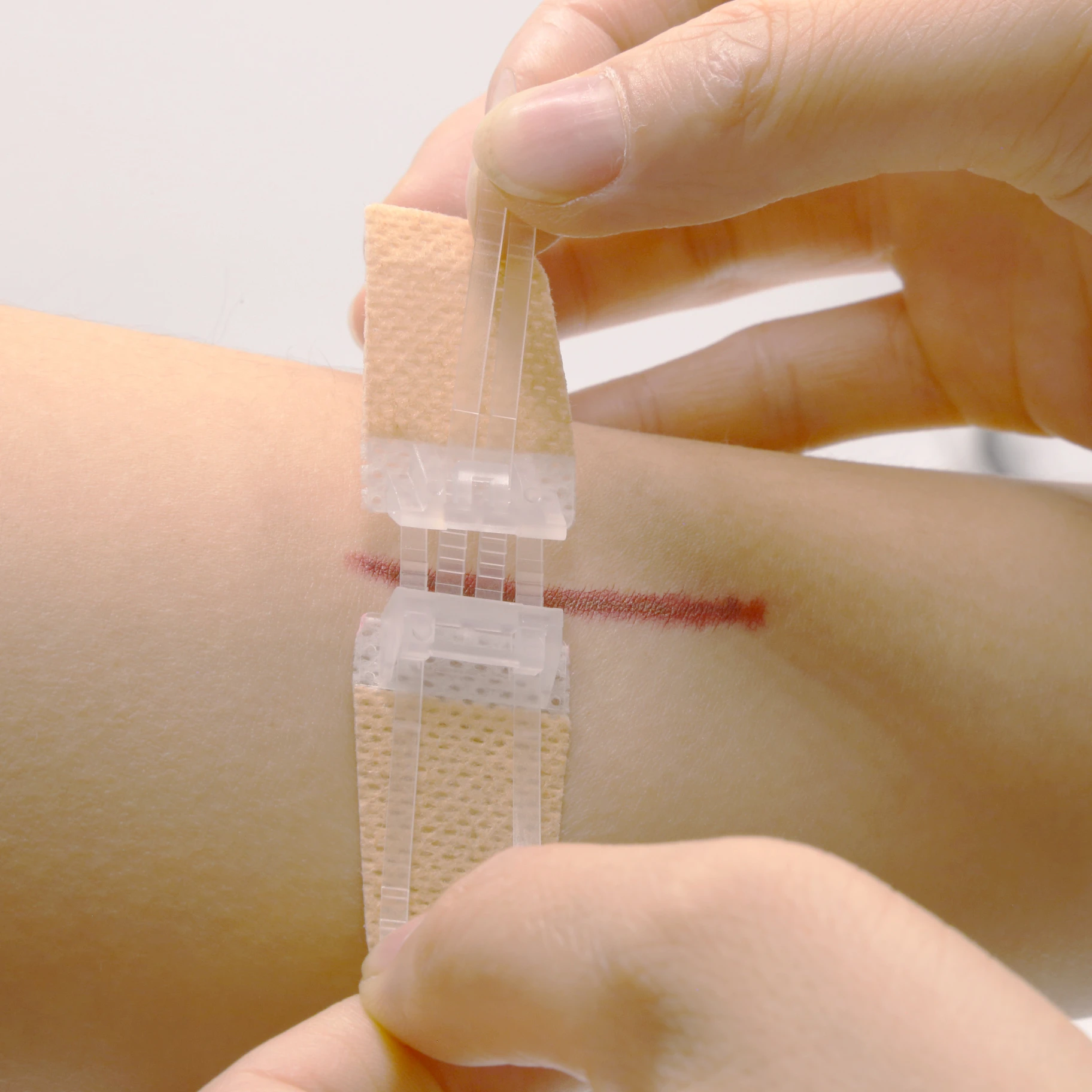 wound closure device Suture materials and equipment Seamless tape Wound suture