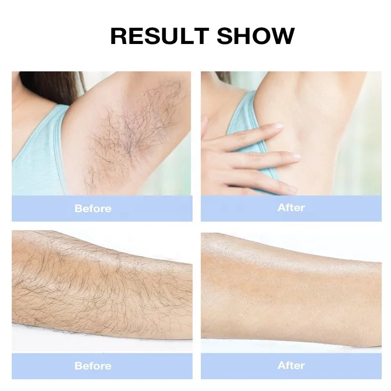 IPL hair removal and skin rejuvenation home used beauty machine ipl hair removal machine