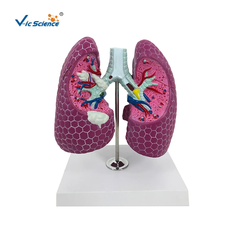 Biology Model for Left and Right Lung for Hospital Usage