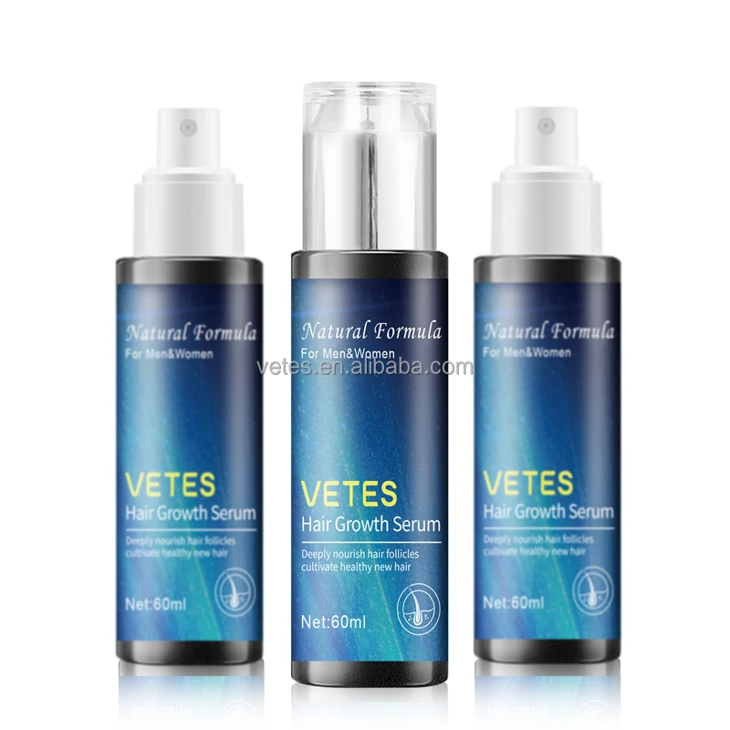 Wholesale Herbal Extract Formula 60ml  Hair Growth Essential Oil For Hair Loss Treatment Regrowth Serum