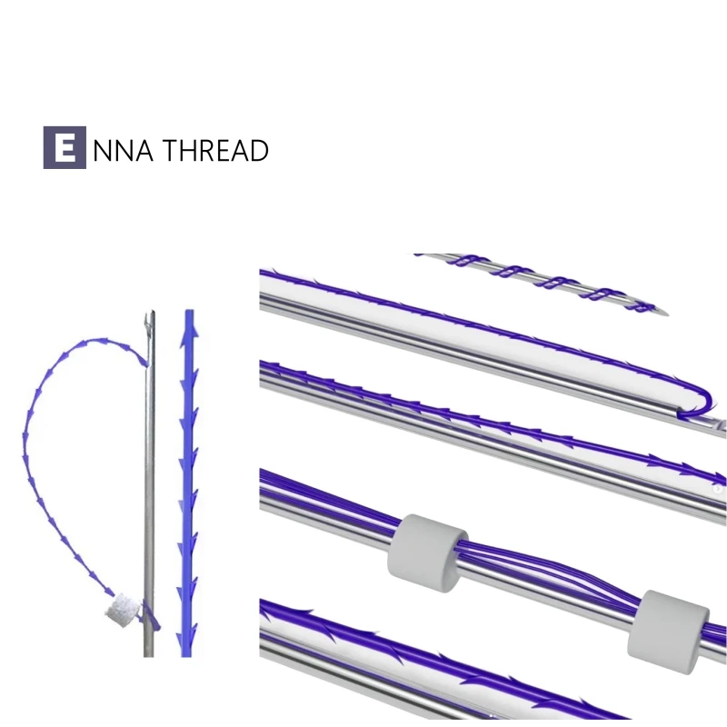 ENNA pdo pcl plla  threads south korea mono and screw 26g 29g 30g