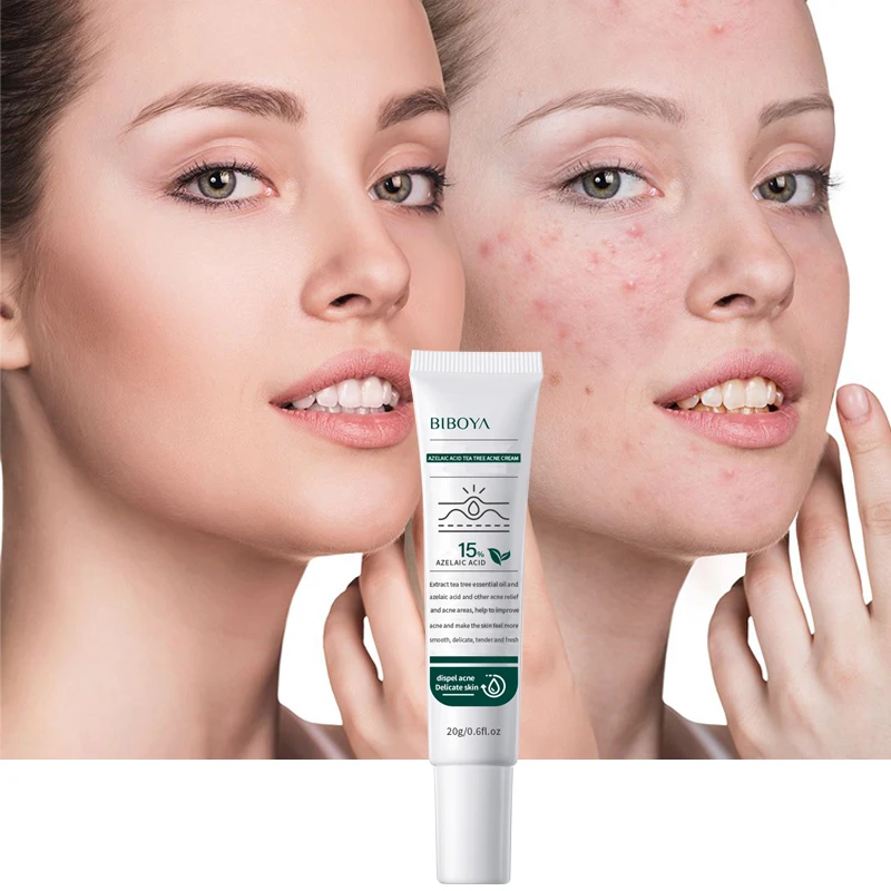 Private Label azelaic acid tea tree acne cream lightens acne scars repairs acne-prone skin Moisturizing and moisturizing
