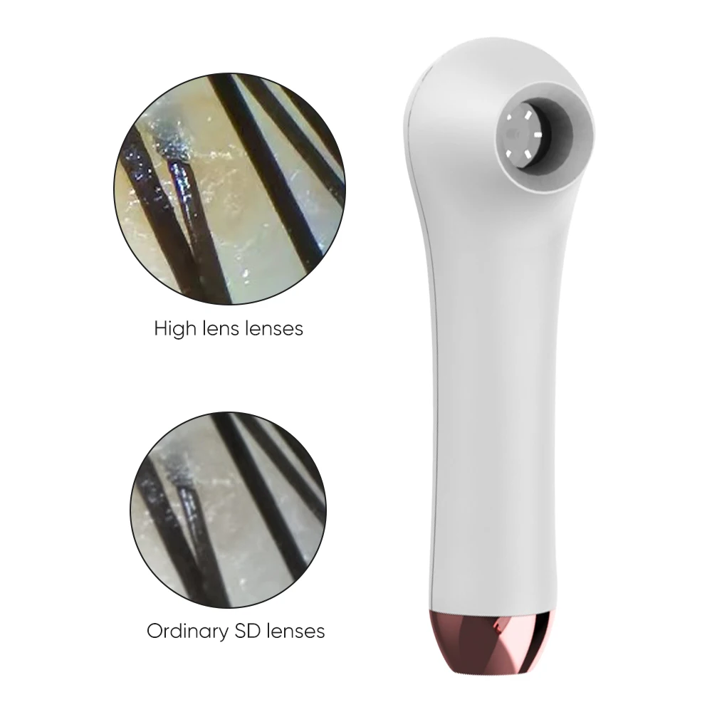 Advanced Scalp Analyzer with ABS Body and 1m OTG Cable for Home Use