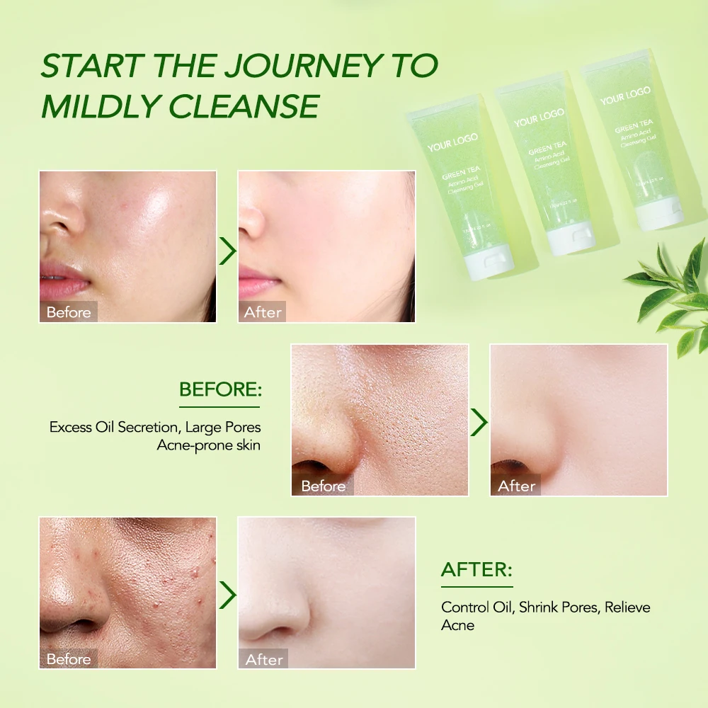 Private Label Hydrating Facial Jelly Cleanser Green Tea Face Wash Amino Acid Gentle Cleansing Gel