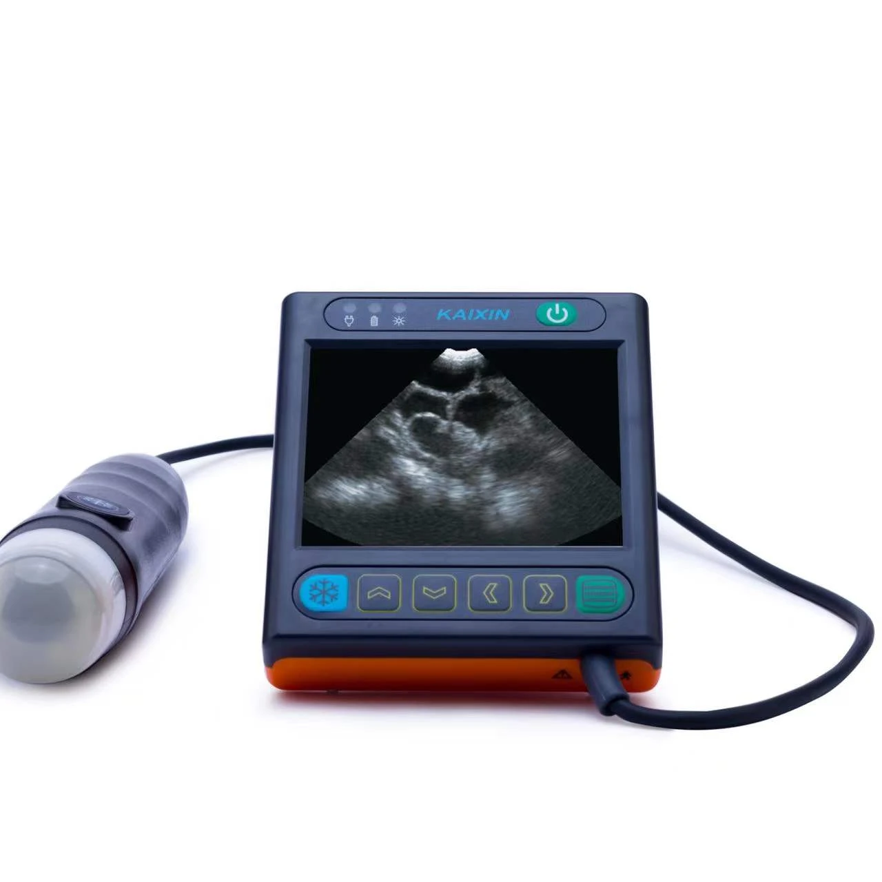 Hospital Equipment Ultrasound Scan Color Doppler Machine for Diagnosis
