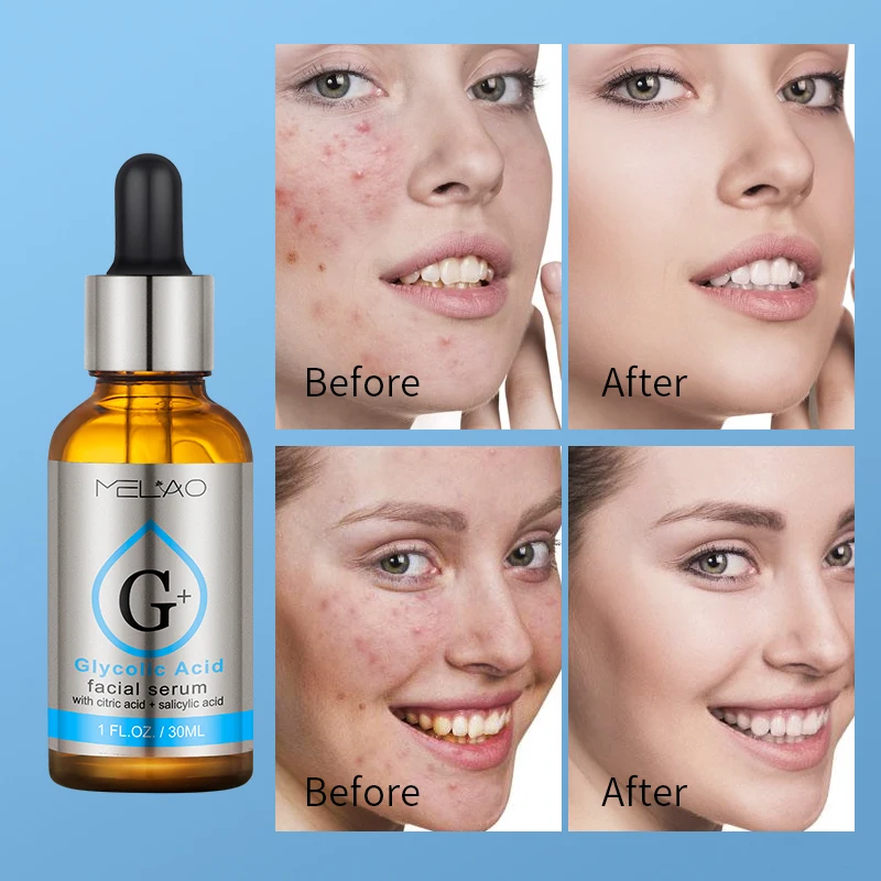 Wholesale Hot selling Private Label Natural organic Anti-aging Smooth Wrinkles Anti Acne Treatment Collagen Glycolic Acid serum