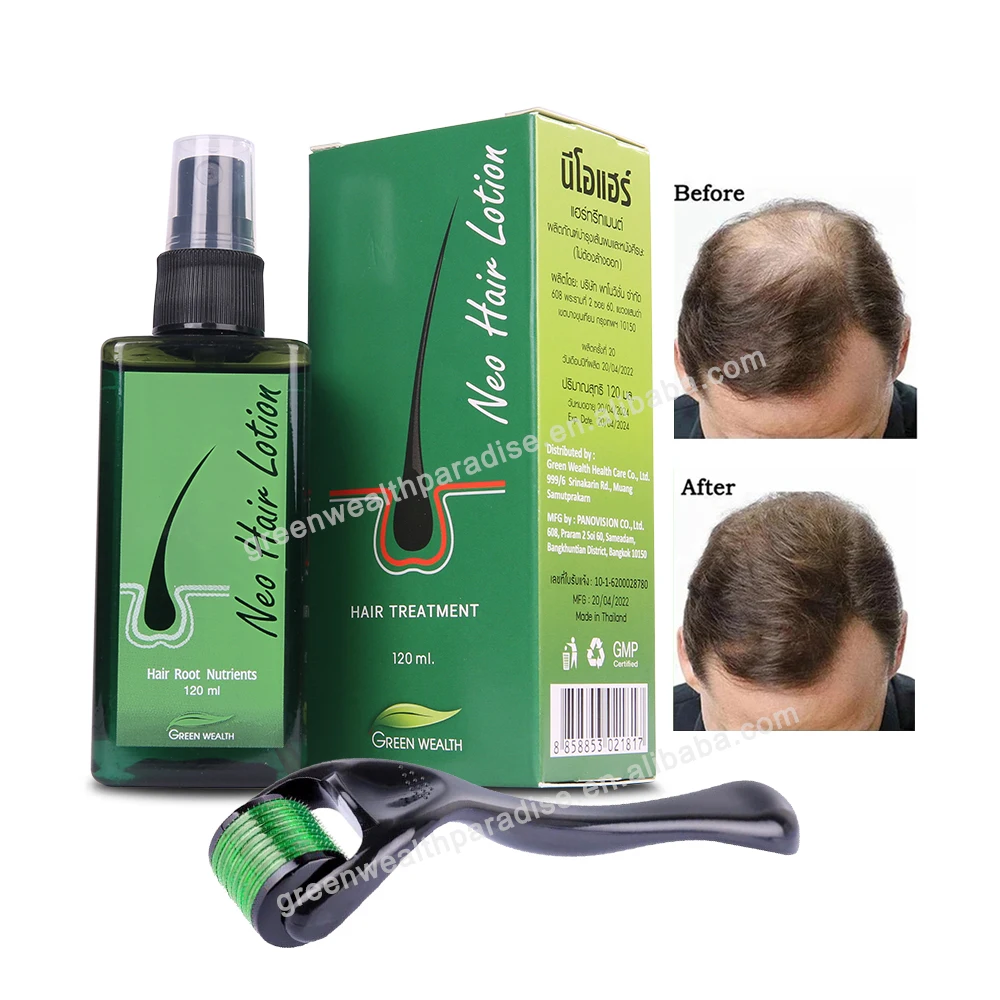 Hot Sell 120ML Neo Hair Lotion Green Wealth Thailand fast growth hair oil for Men and Women