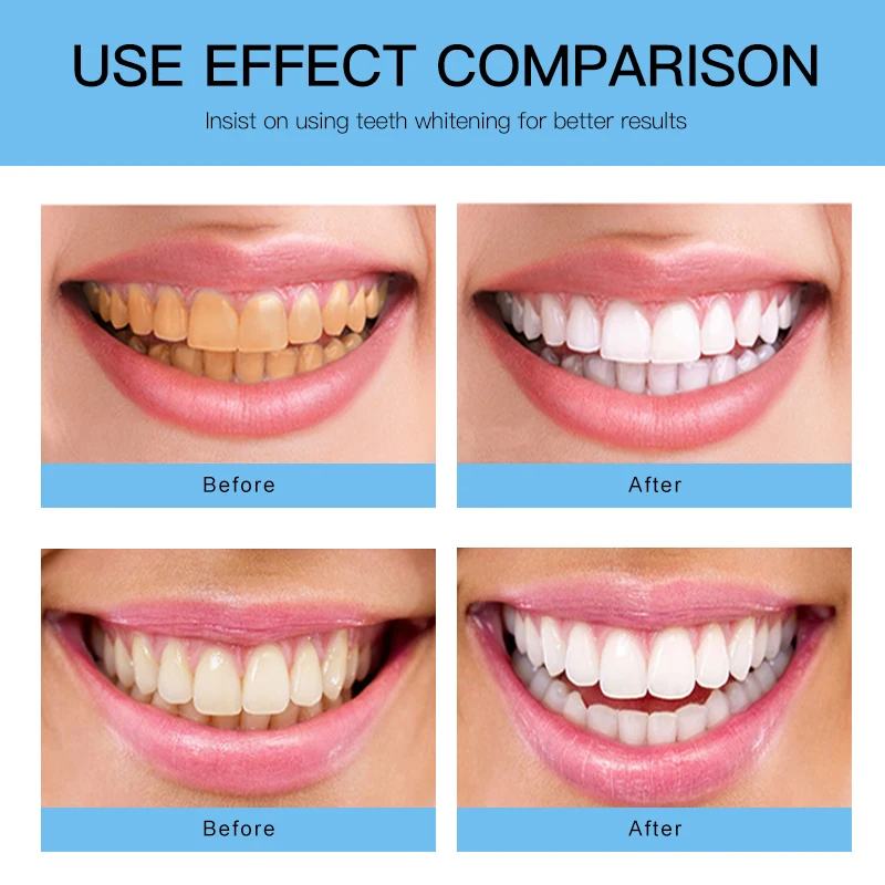 Environmentally Friendly Recyclable Oral Brush head Electric Toothbrush Replacement Tooth Brush Bamboo Electric Toothbrush Head