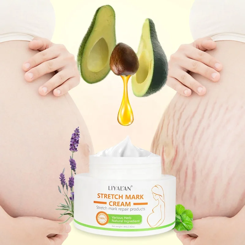 Korean Private Label Scar Removal Firming Body Cream Natural Maternity Skin Care Stretch Marks Removal Cream