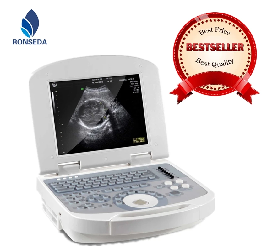 Veterinary Laptop Ultrasound Scanner Animals   Diagnosis