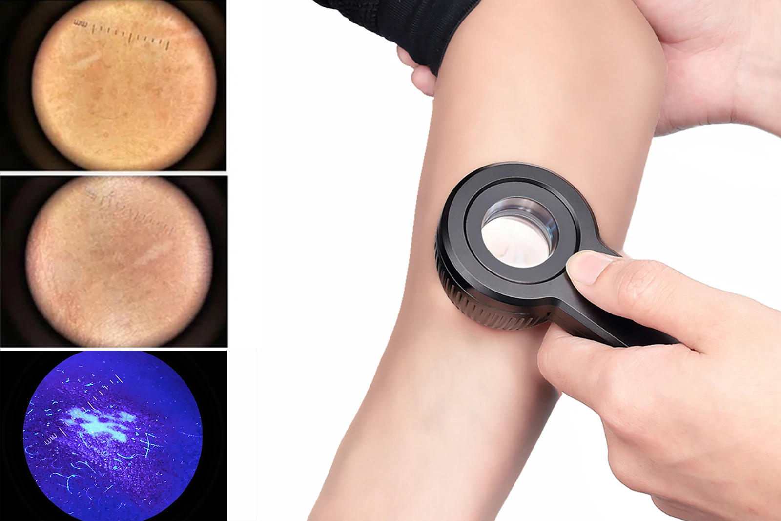 IBOOLO Electronic Dermatoscope DE-3100 PRO Polarized and UV LED Light Dermatoscope for Dermatology