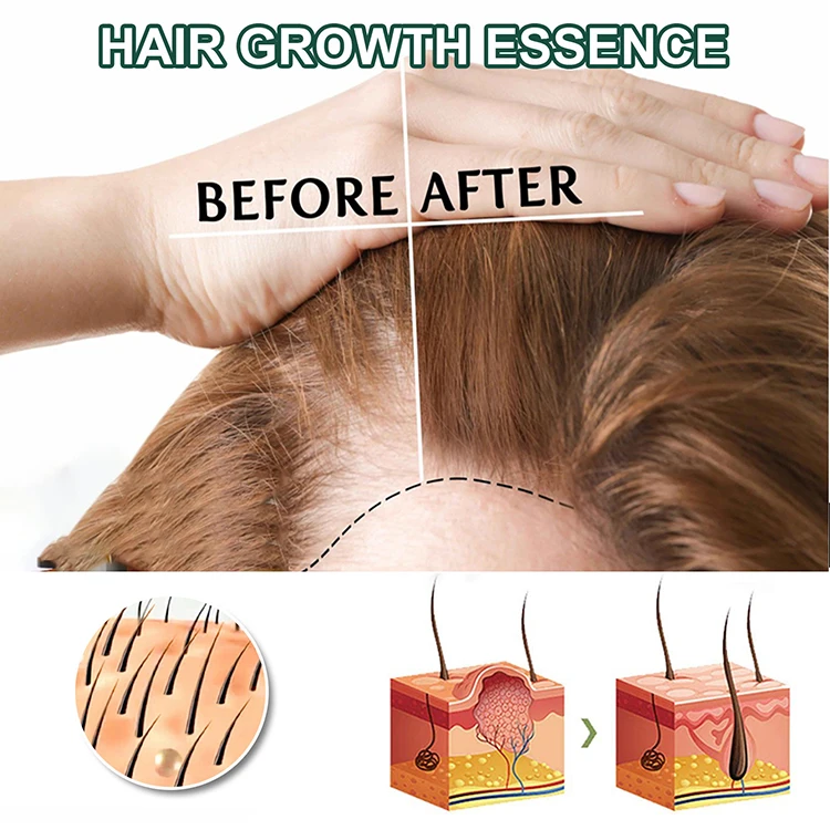 Wholesale Organic Natural Ginseng Hair Growth Serum Spray 30ML Fast Hair Function Growth Serum for Loss Prevention
