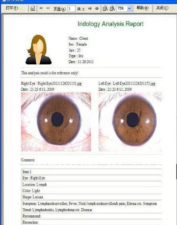Профессиональная 8mp Iridology камера iEye iScope по лучшей цене