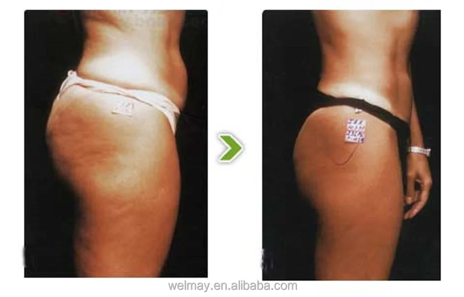 Portable 28 Channels Lymphatic Drainage Pressotherapy Balancer Sport Body Slimming Pressotherapy Air Compression Portable