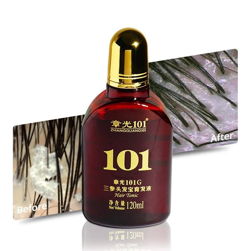 Zhangguang 101 Organic Hair Treatment Oil Control Hair Care Product