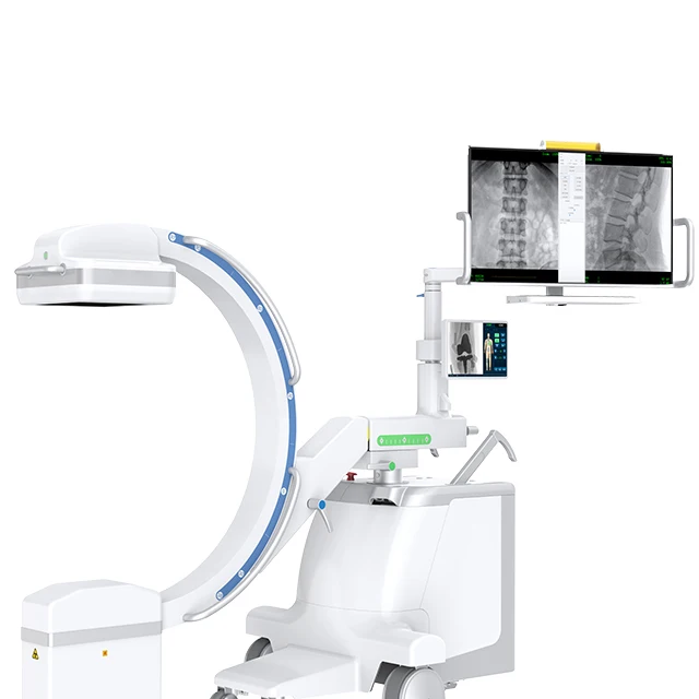 High Quality C-arm System With Wireless Transmission Supplier