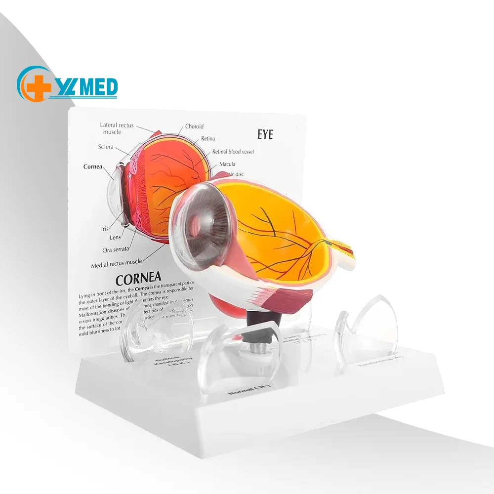 6 раз, инструменты для анатомического обучения глазам, внутренняя структура, обучающий инструмент, ресурсы, модель глазного яблока для обучения векам