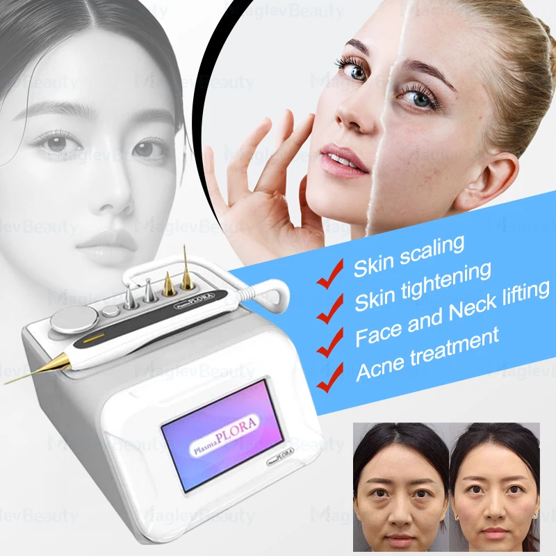 Korea Plasma Plora Fractional Cold Plasma Jet Plasma Plora Machine For Spots And Wrinkles Removal Mole Acne Scar Removal