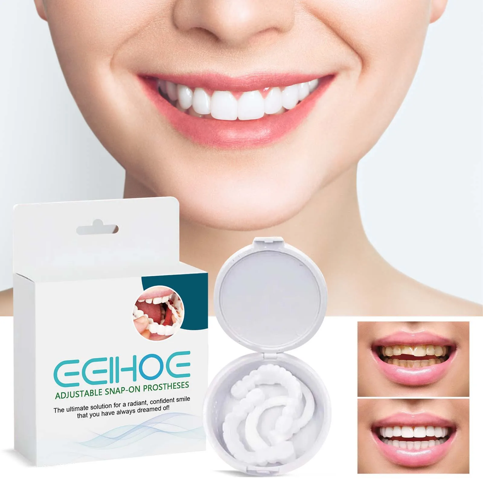 Perfect Smile Veneers Whitening Kit Temporary Dental Oral False Teeth Dentures Mint Flavor Silicone Gel Denture Paste Braces Box