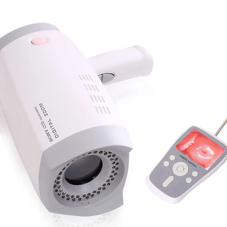 Portable digital video colposcope for gynecological clinical diagnostic equipment