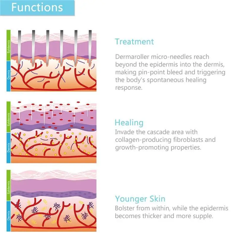 
Needle Mesotherapy Roll 540 Needles Derma Roller 540 Needles Derma Roller work for acne scars, sagging aging skin 
