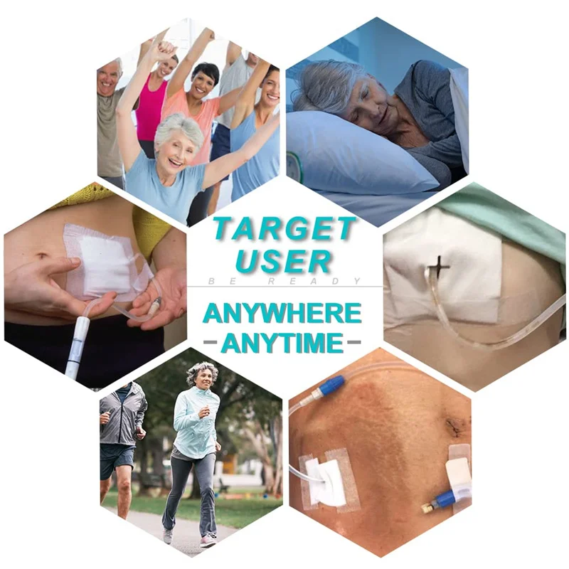 Breathable Peritoneal Dialysis Belt with Mesh Pocket PD Catheter Holder Accessories Secure Transfer Set Peg