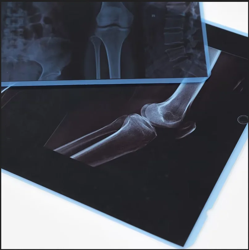 100 Pieces Per Pack A4 14'x17' Medical Inkjet X-ray Imaging Blue Film for medical devices