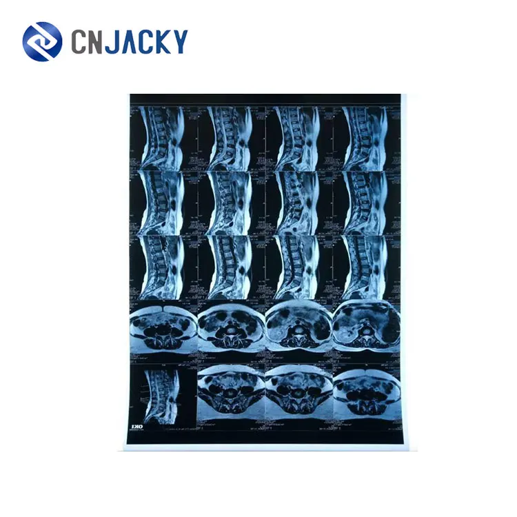 Cheap medical blue green sensitive medical dental x-ray film