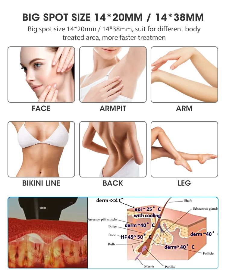 Customized Soprano Ice Platinum 1600w Tria Beauty 808 Laser Hair Removal Permanently System Diode Laser 3 Wavelength Machine