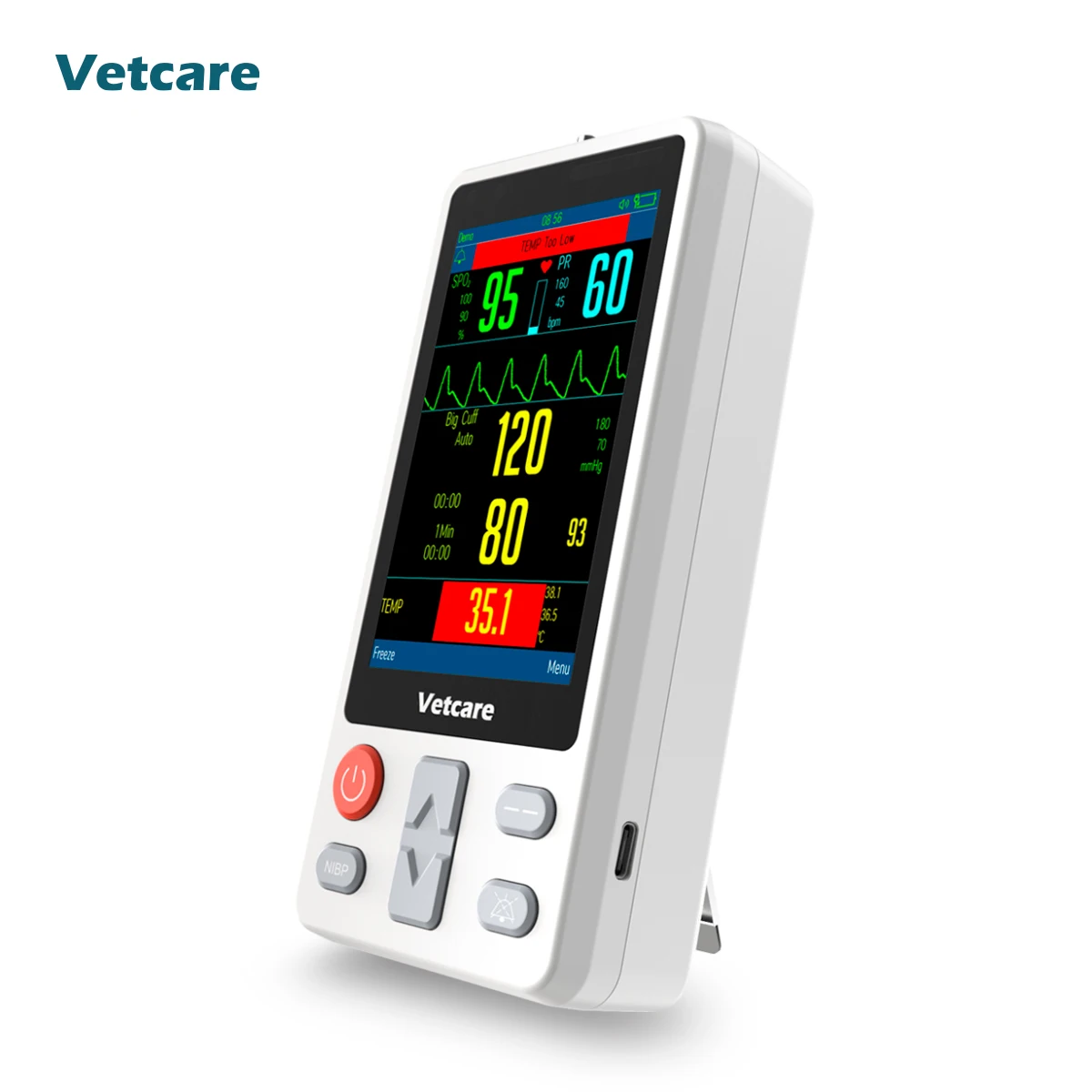 Special design of handheld monitor HMvet series:the anti-interference ability from motion and detection even at low perfusion