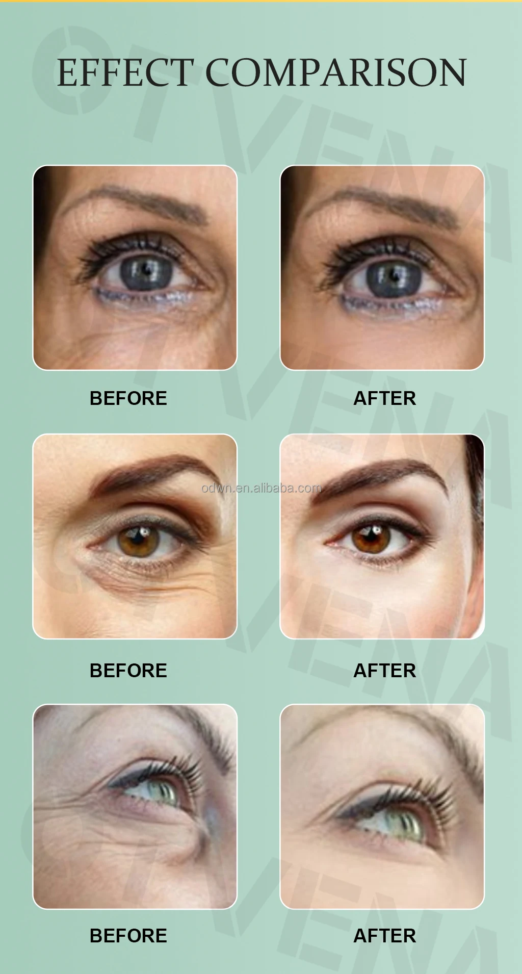 Plump Tone And Tighten Skin With OTVENA Best Wrinkle Cream Anti Aging Products