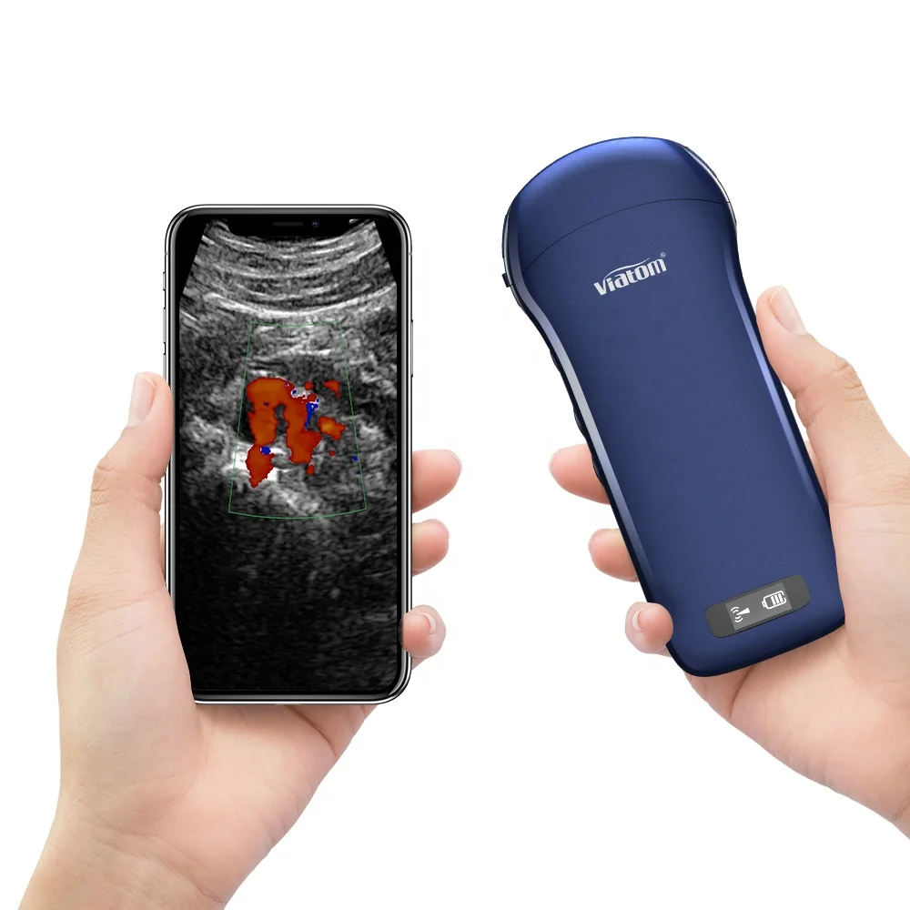 Ультразвуковой портативный беспроводной сканер Viatom C10 карманное ультразвуковое
