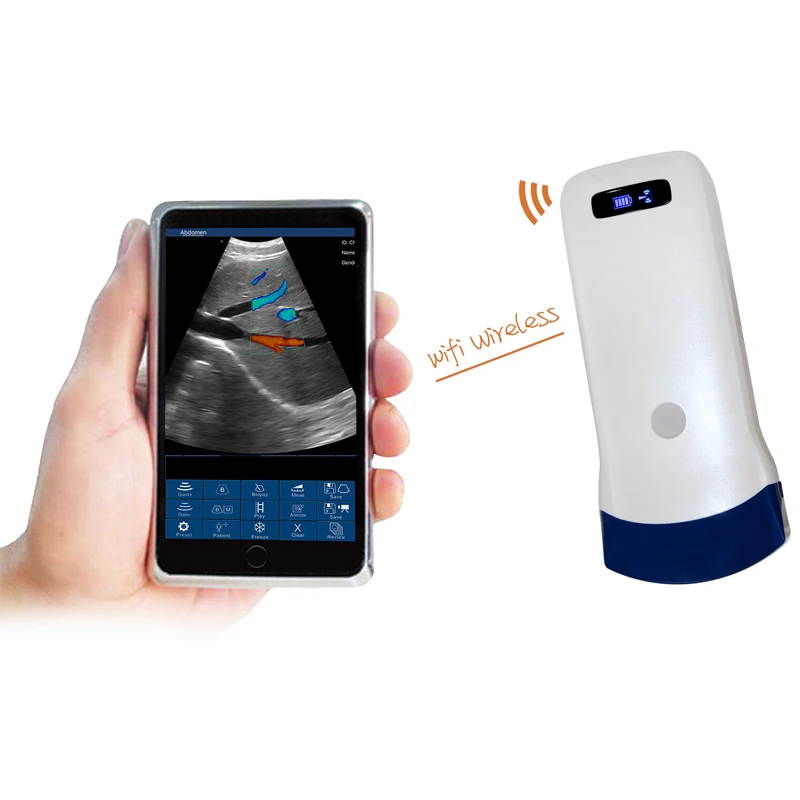 128 elements veterinary pregnancy portable handheld convex and linear wireless ultrasound scanner for cow