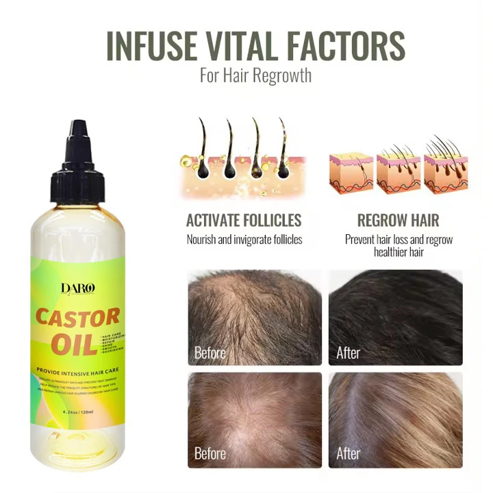 ODM/OEM Hair Care Essence Strengthening Repair Castor Oil Nourishing Organic Hair Treatment Oil